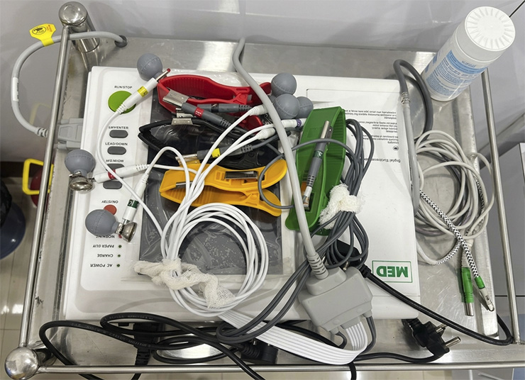 Importance of ECG Monitoring in Modern Healthcare