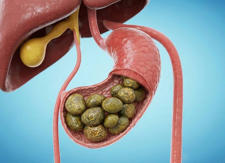 Simple Daily Habits for Gallbladder Health